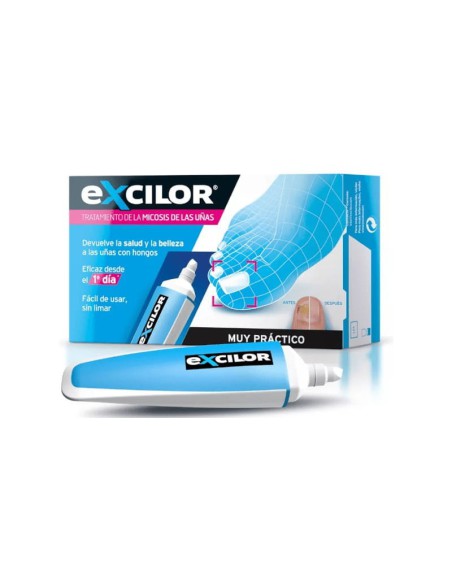 EXCILOR : INFECION POR HONGOS EN LAS UÑAS